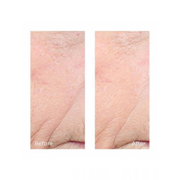 Сироватка для освітлення та вирівнювання тону Perricone MD CCC + Ferulic Brightening Complex 20% 59mL