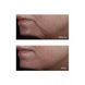 Мощная лифтинг-сыворотка вокруг глаз Perricone MD Firming Eye Lift 15mL