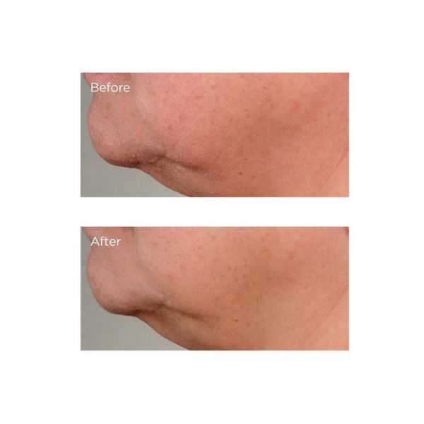 Антивікова ліфтинг-сироватка Perricone MD Growth Factor Firming & Lifting Serum 59mL