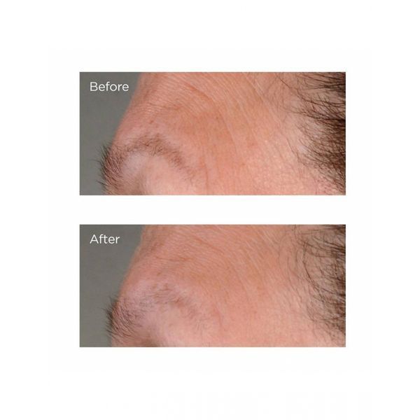 Антивікова ліфтинг-сироватка Perricone MD Growth Factor Firming & Lifting Serum 59mL