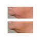 Антивікова ліфтинг-сироватка Perricone MD Growth Factor Firming & Lifting Serum 59mL