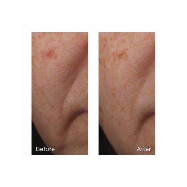 Антивікова сироватка-гель для обличчя Perricone MD Cold Plasma+ 30mL