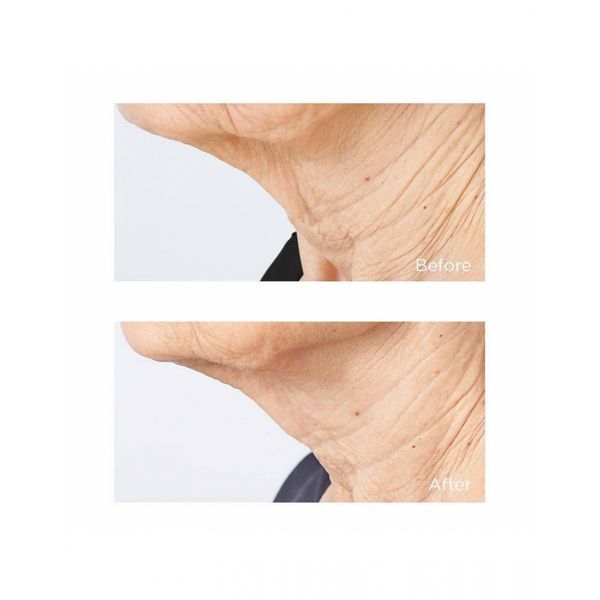 Антивозрастная сыворотка для контура лица и шеи Perricone MD Sub D/Neck 59mL