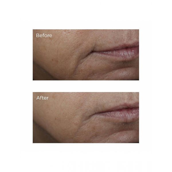 Осветляющая сыворотка Perricone MD Brightening Amine Face Lift 59mL