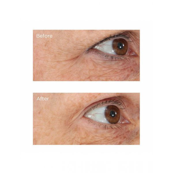 Лифтинг сыворотка для глаз Perricone MD Acyl-Glutathione Eyelid Serum 15mL