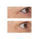 Лифтинг сыворотка для глаз Perricone MD Acyl-Glutathione Eyelid Serum 15mL