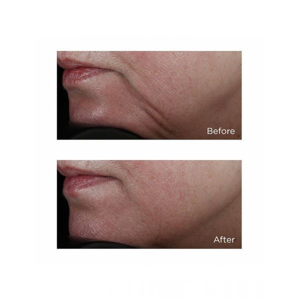 Потужна ліфтінг-сироватка Perricone MD Classics Face Firming Serum 59mL