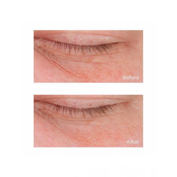 Антивозрастная крем-сыворотка вокруг глаз Perricone MD Cold Plasma Eye+ 15mL