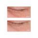 Антивозрастная крем-сыворотка вокруг глаз Perricone MD Cold Plasma Eye+ 15mL