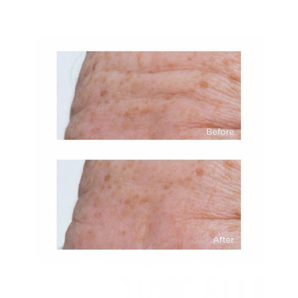 Ліфтинг-подушечки з ДМАЕ Perricone MD DMAE Firming Pads 60шт