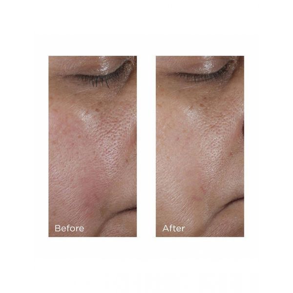 Тоник для уменьшения пор Perricone MD Intensive Pore Minimizing Toner 118mL