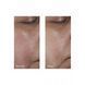 Тоник для уменьшения пор Perricone MD Intensive Pore Minimizing Toner 118mL