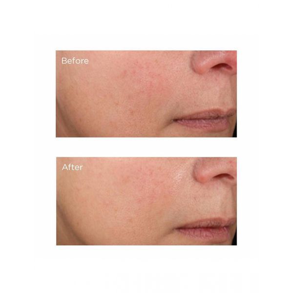 Тональная сыворотка Perricone MD NM Foundation Serum SPF 20 Beige 30mL