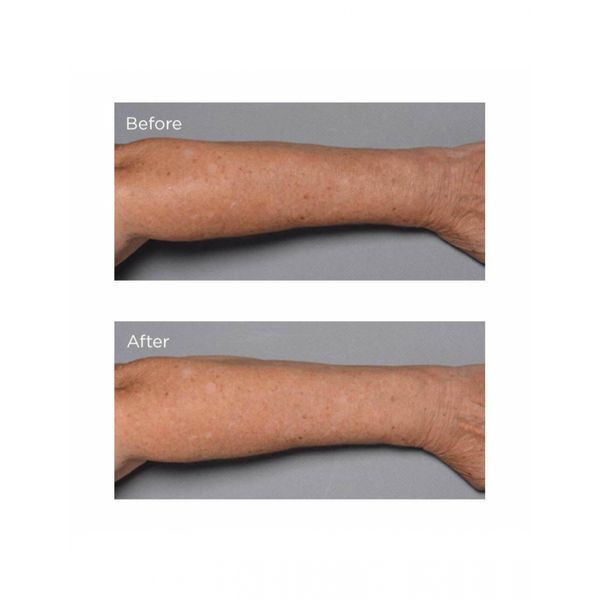 Укрепляющий и восстанавливающий крем для тела Perricone MD Cold Plasma+ Fragile Skin Therapy 177mL