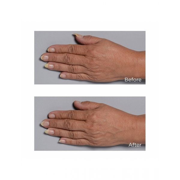 Омоложуючий крем для рук Perricone MD Hand Therapy 59mL